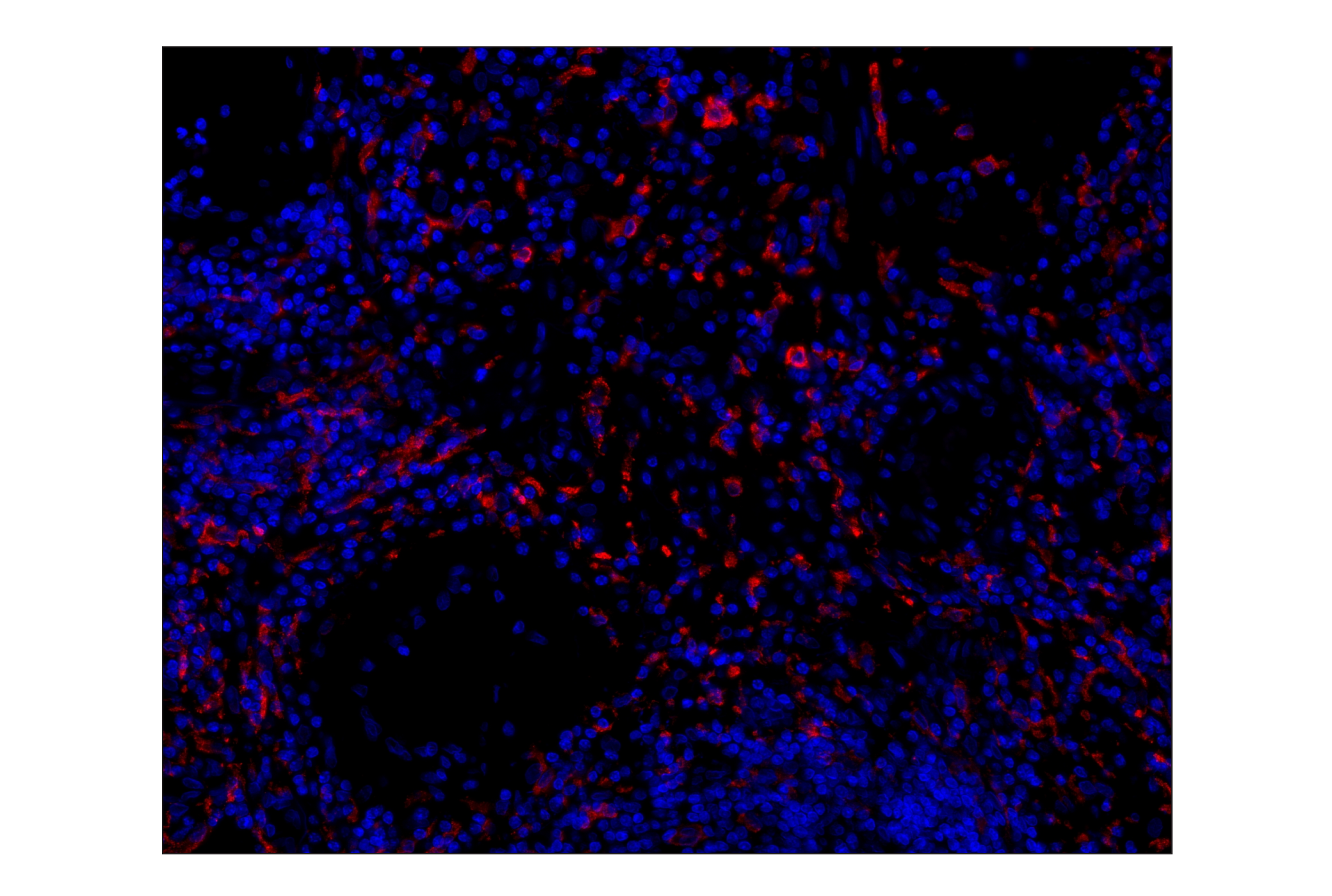 Immunohistochemistry Image 1: CD163 (D6U1J) Rabbit mAb (Alexa Fluor® 555 Conjugate)
