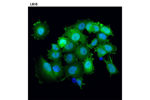 Immunofluorescence Image 1: Thymidylate Synthase (D5B3) XP® Rabbit mAb