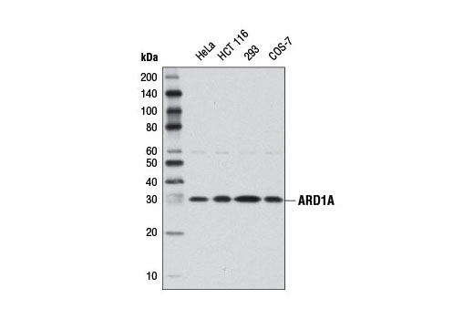 Western Blotting Image 1: ARD1A Antibody