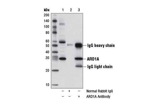 Immunoprecipitation Image 1: ARD1A Antibody