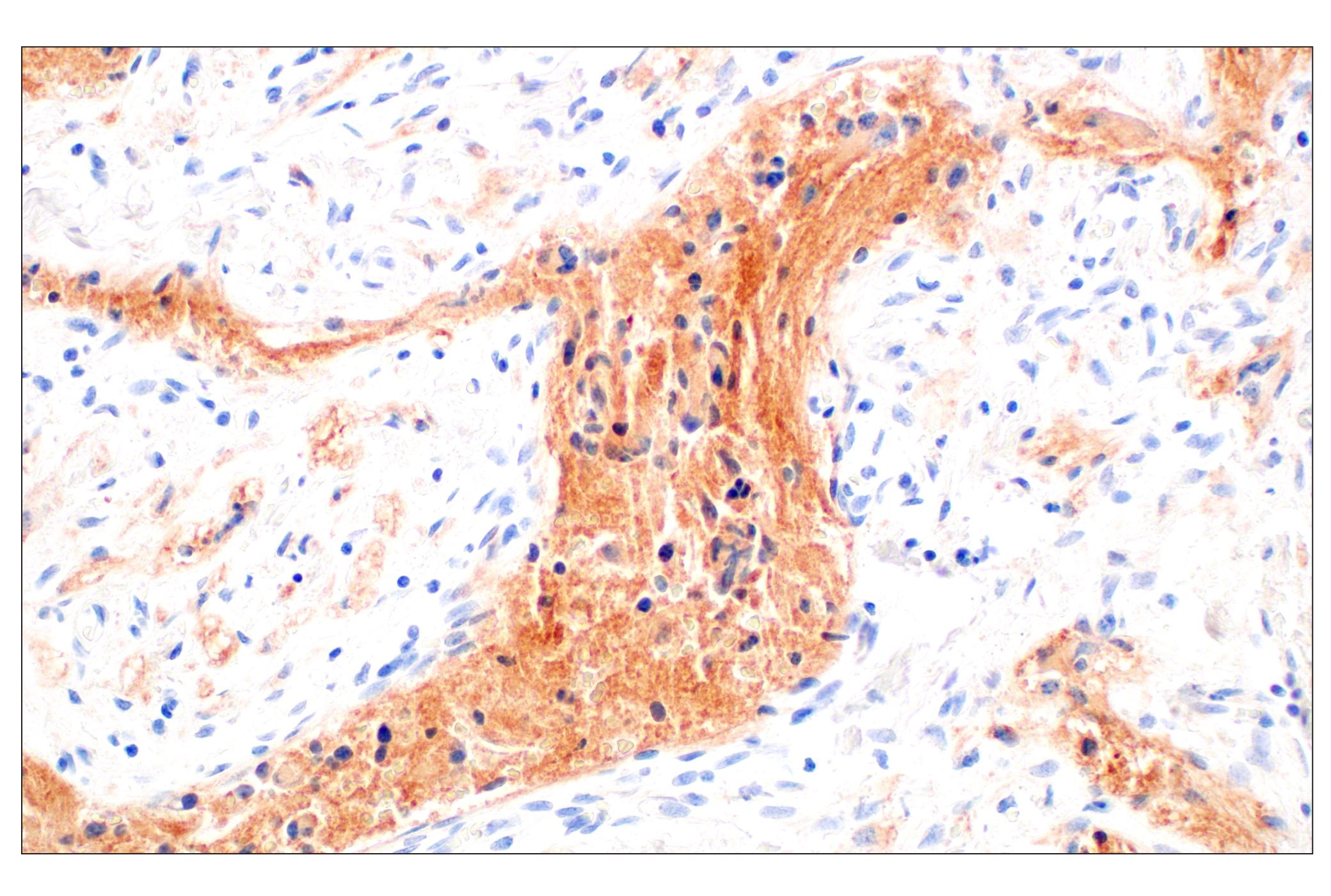 Immunohistochemistry Image 1: GPC2 (CT3) Mouse mAb