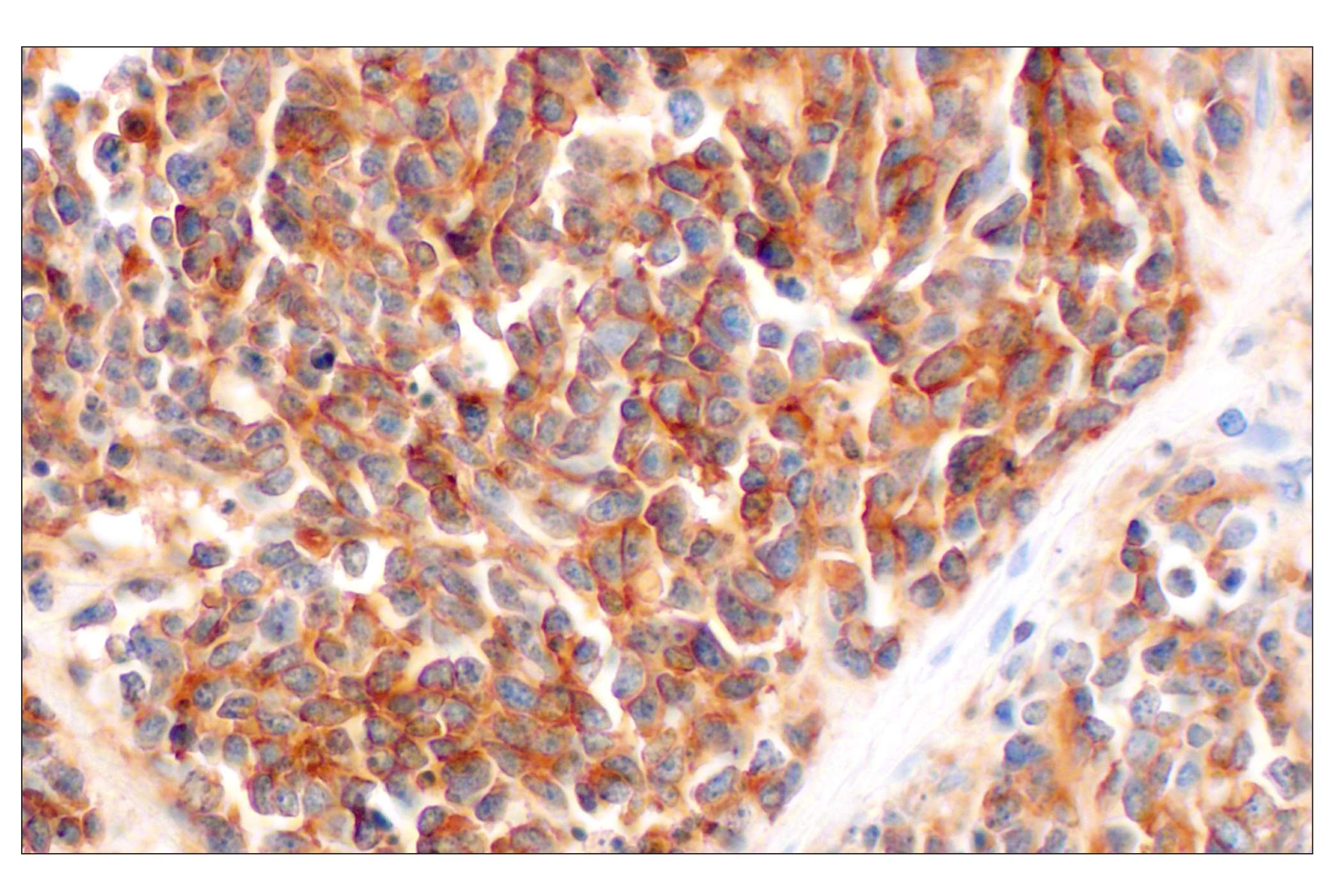 Immunohistochemistry Image 2: GPC2 (CT3) Mouse mAb