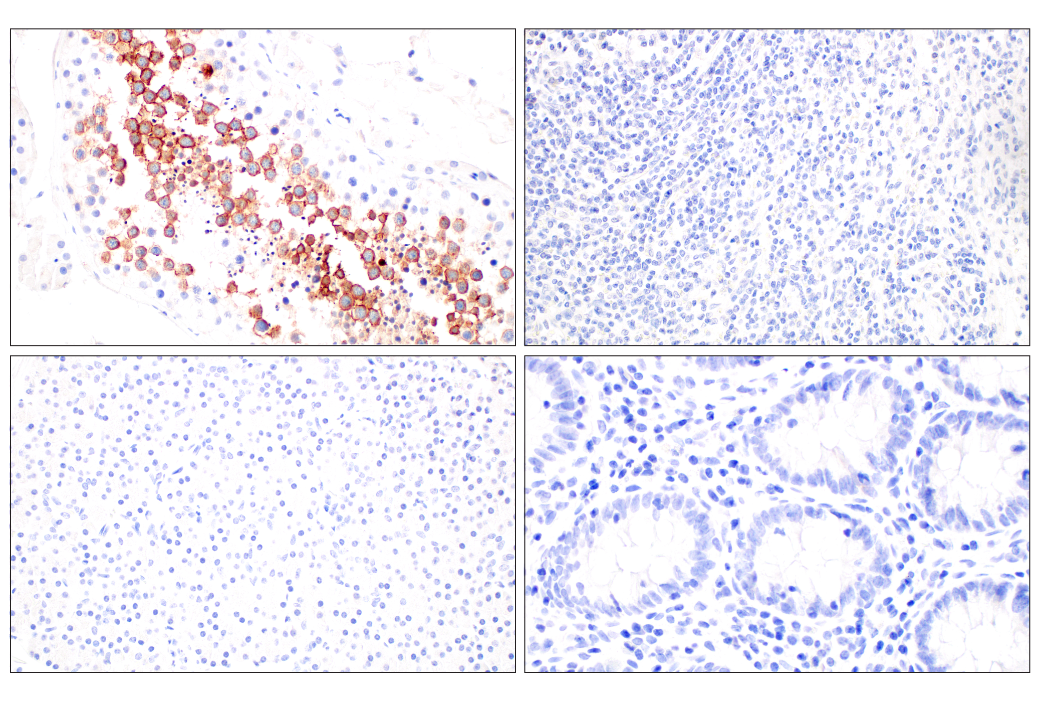 Immunohistochemistry Image 3: GPC2 (CT3) Mouse mAb