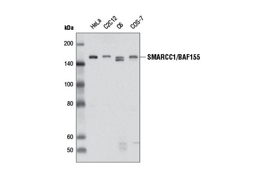 Western Blotting Image 1: SMARCC1/BAF155 Antibody