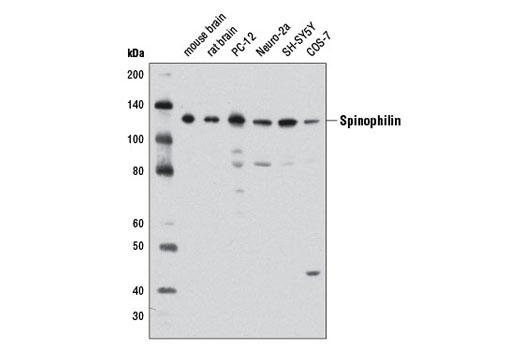 Western Blotting Image 1: Spinophilin Antibody