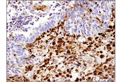 Immunohistochemistry Image 2: ALDH1A1 (D9Q8E) XP® Rabbit mAb (BSA and Azide Free)