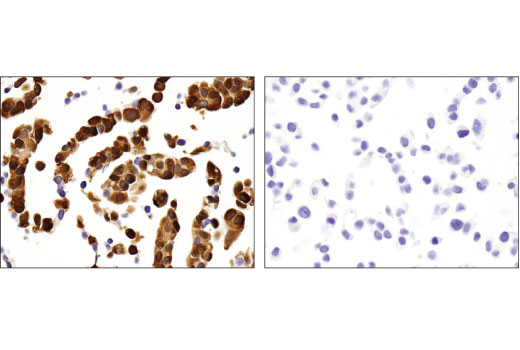 Immunohistochemistry Image 3: ALDH1A1 (D9Q8E) XP® Rabbit mAb (BSA and Azide Free)