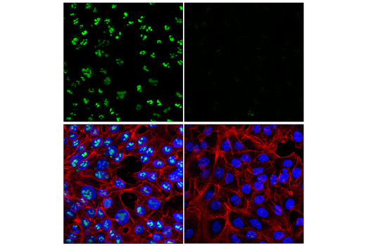 Immunofluorescence Image 1: NOP2 (E9Z4D) Rabbit mAb
