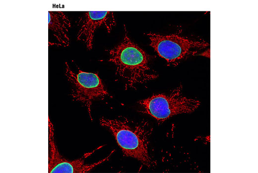 Immunofluorescence Image 1: MitoTracker® Red CMXRos