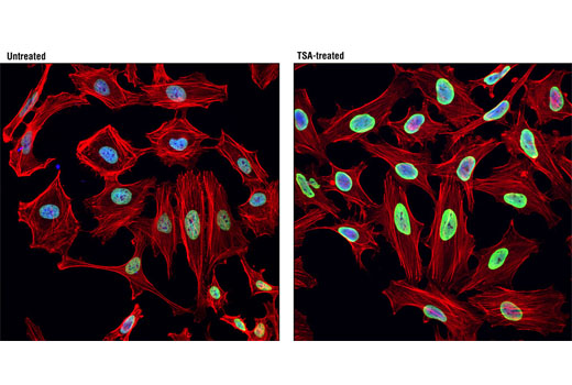 Immunofluorescence Image 1: Acetyl-Histone H2B (Lys15) (D8H1) XP® Rabbit mAb