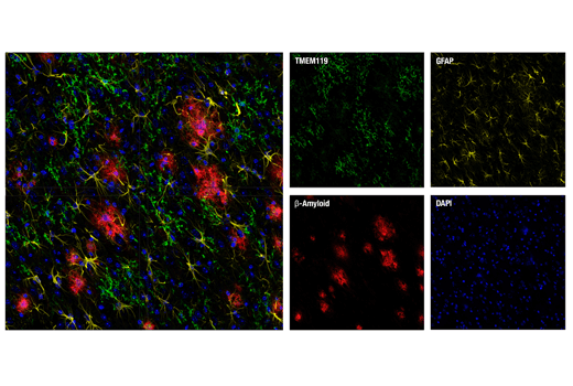  Image 18: Mouse Reactive Alzheimer's Disease Model Microglia Phenotyping IF Antibody Sampler Kit