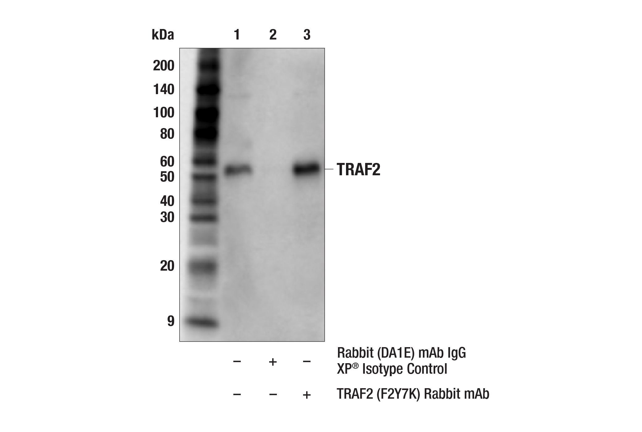 Immunoprecipitation Image 1: TRAF2 (F2Y7K) Rabbit mAb