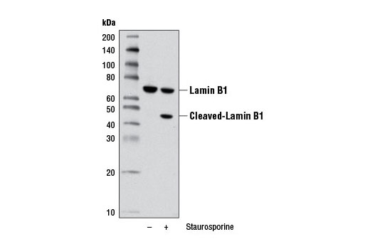 Western Blotting Image 2: Lamin B1 Antibody