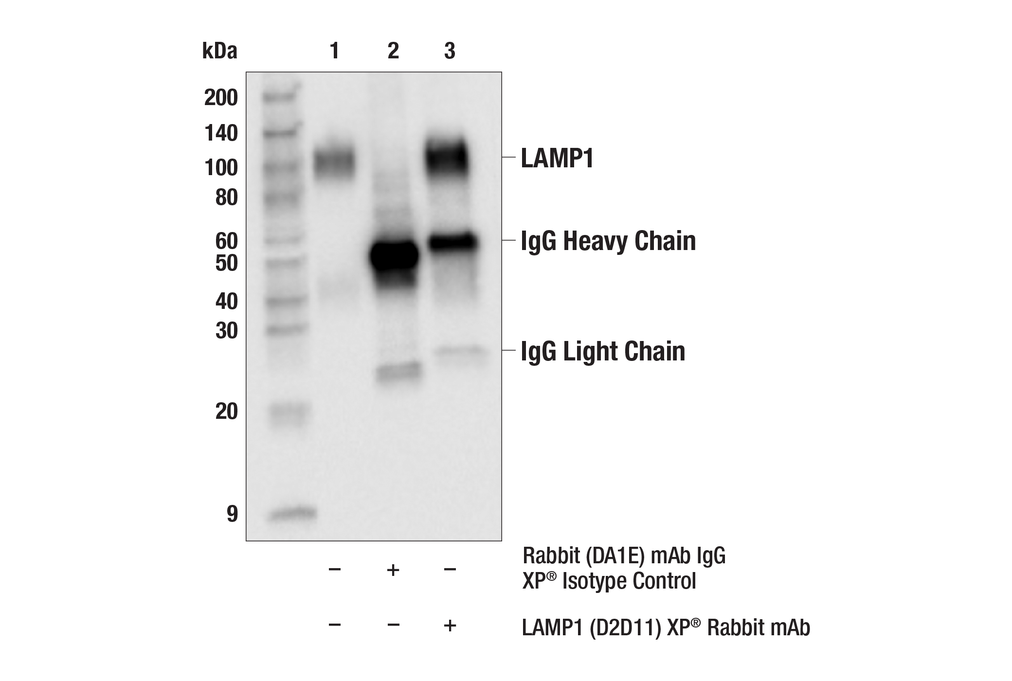  Image 5: Lysosomal Marker Antibody Sampler Kit