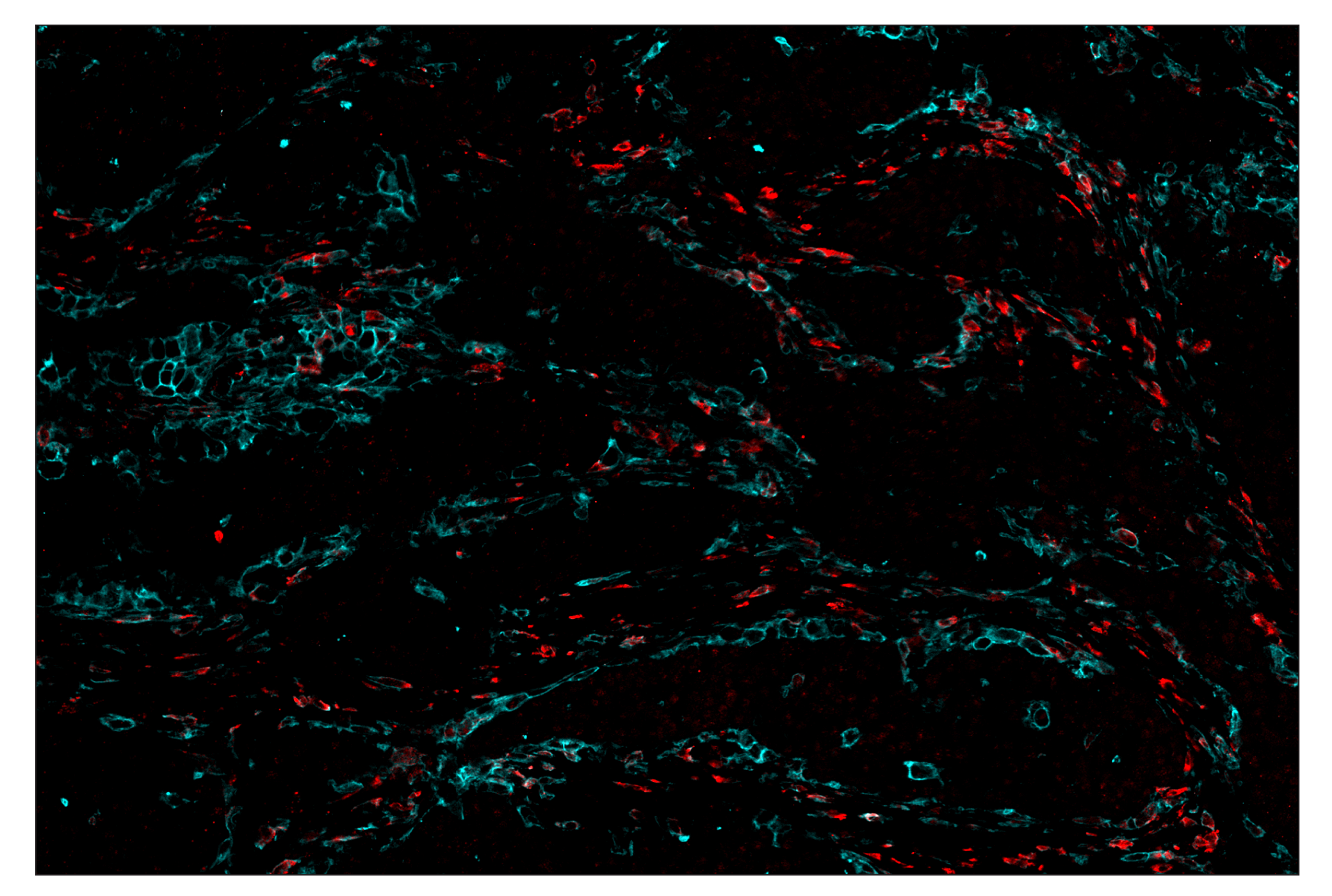 Immunohistochemistry Image 7: CD206/MRC1 (E2L9N) & CO-0035-750 SignalStar™ Oligo-Antibody Pair