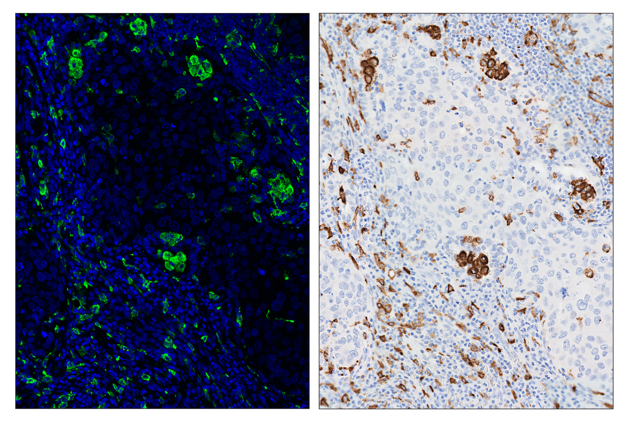 Immunohistochemistry Image 6: CD206/MRC1 (E2L9N) & CO-0035-750 SignalStar™ Oligo-Antibody Pair