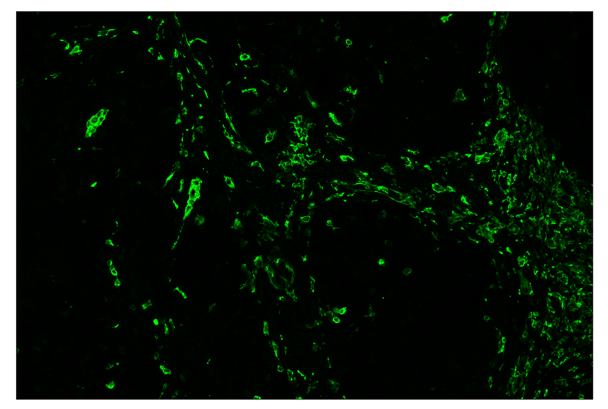 Immunohistochemistry Image 2: CD206/MRC1 (E2L9N) & CO-0035-647 SignalStar™ Oligo-Antibody Pair