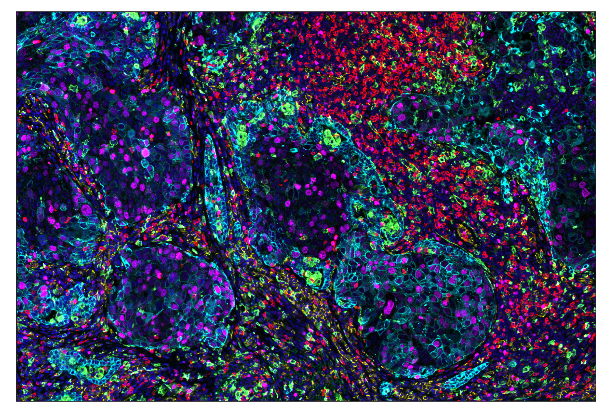 Immunohistochemistry Image 1: CD206/MRC1 (E2L9N) & CO-0035-488 SignalStar™ Oligo-Antibody Pair