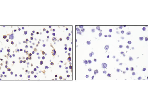 Immunohistochemistry Image 1: CXCR4 (D4Z7W) Rabbit mAb (BSA and Azide Free)