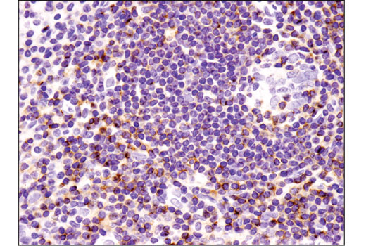 Immunohistochemistry Image 2: CXCR4 (D4Z7W) Rabbit mAb (BSA and Azide Free)