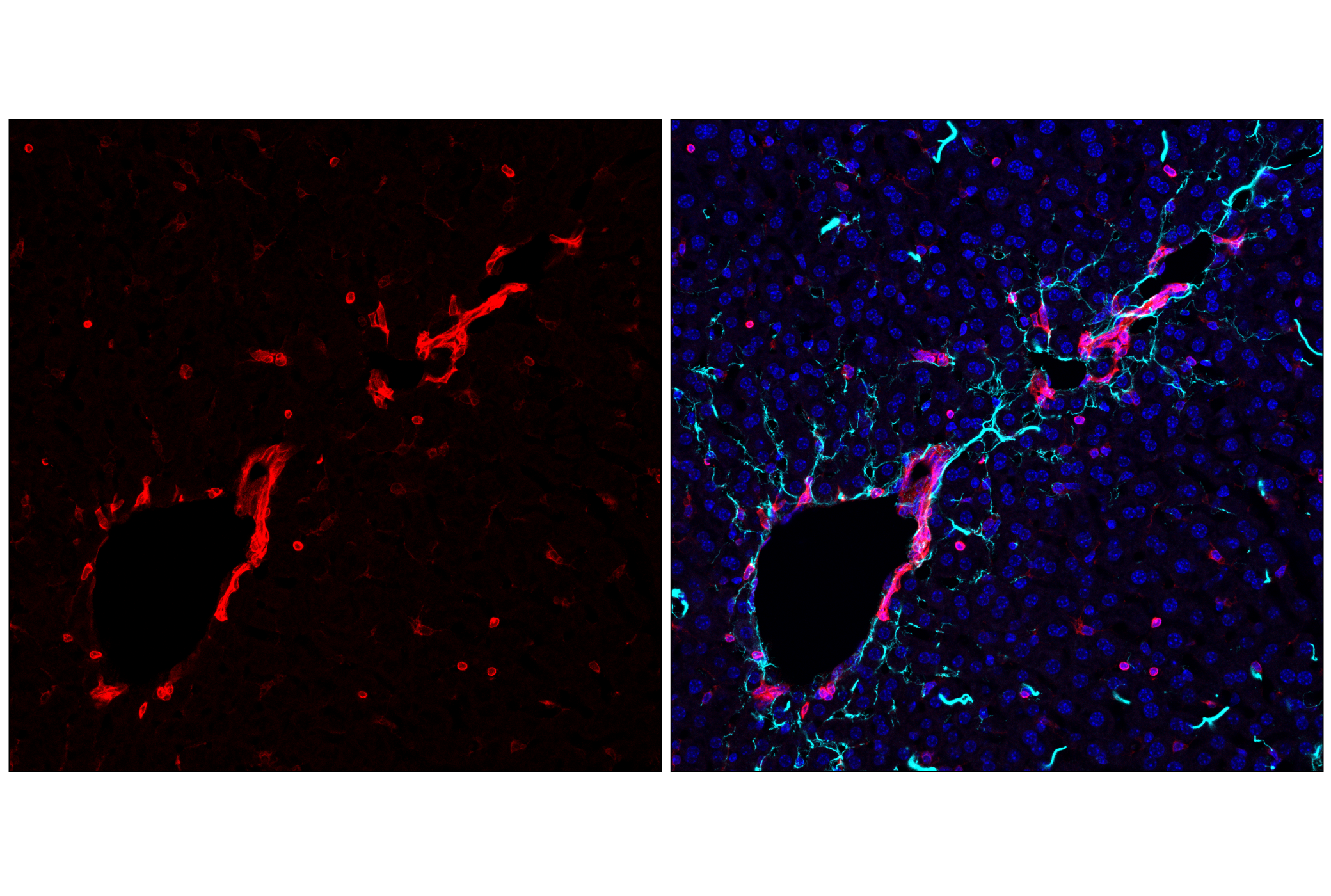 Immunofluorescence Image 3: STING (E9X7F) Rabbit mAb