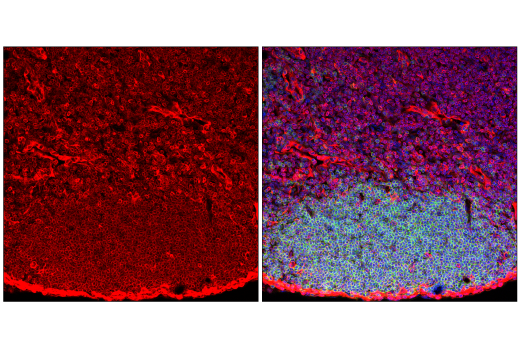 Immunofluorescence Image 1: STING (E9X7F) Rabbit mAb
