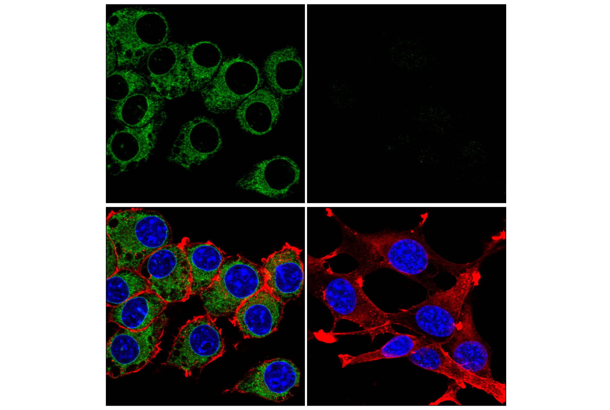 Immunofluorescence Image 4: STING (E9X7F) Rabbit mAb