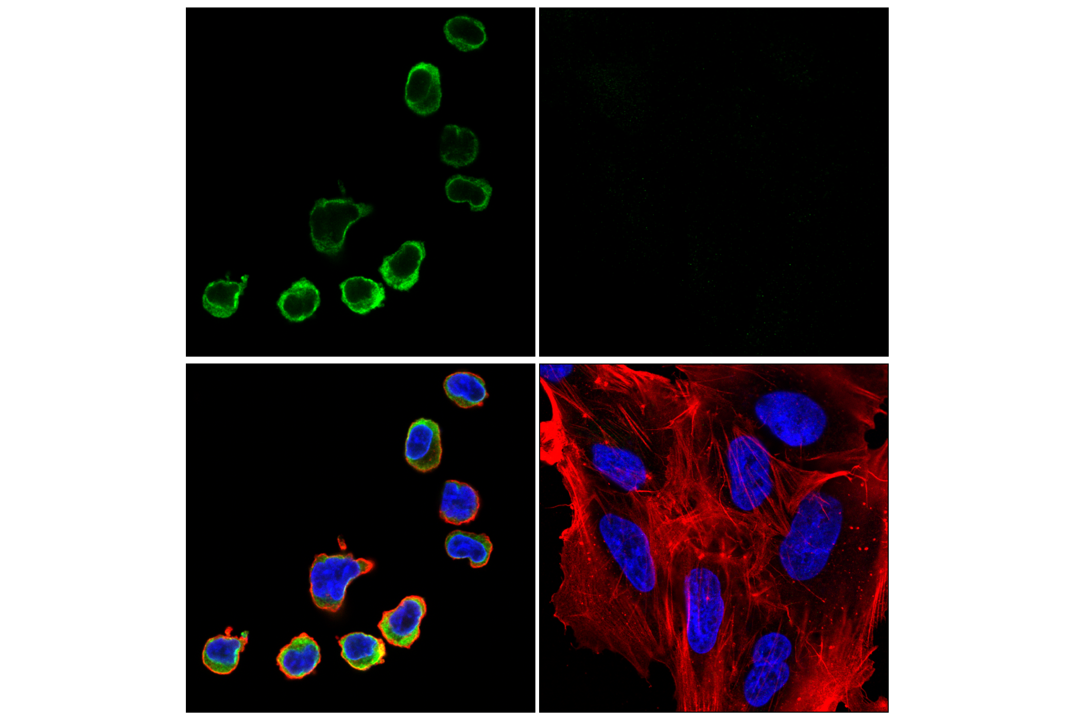 Immunofluorescence Image 5: STING (E9X7F) Rabbit mAb