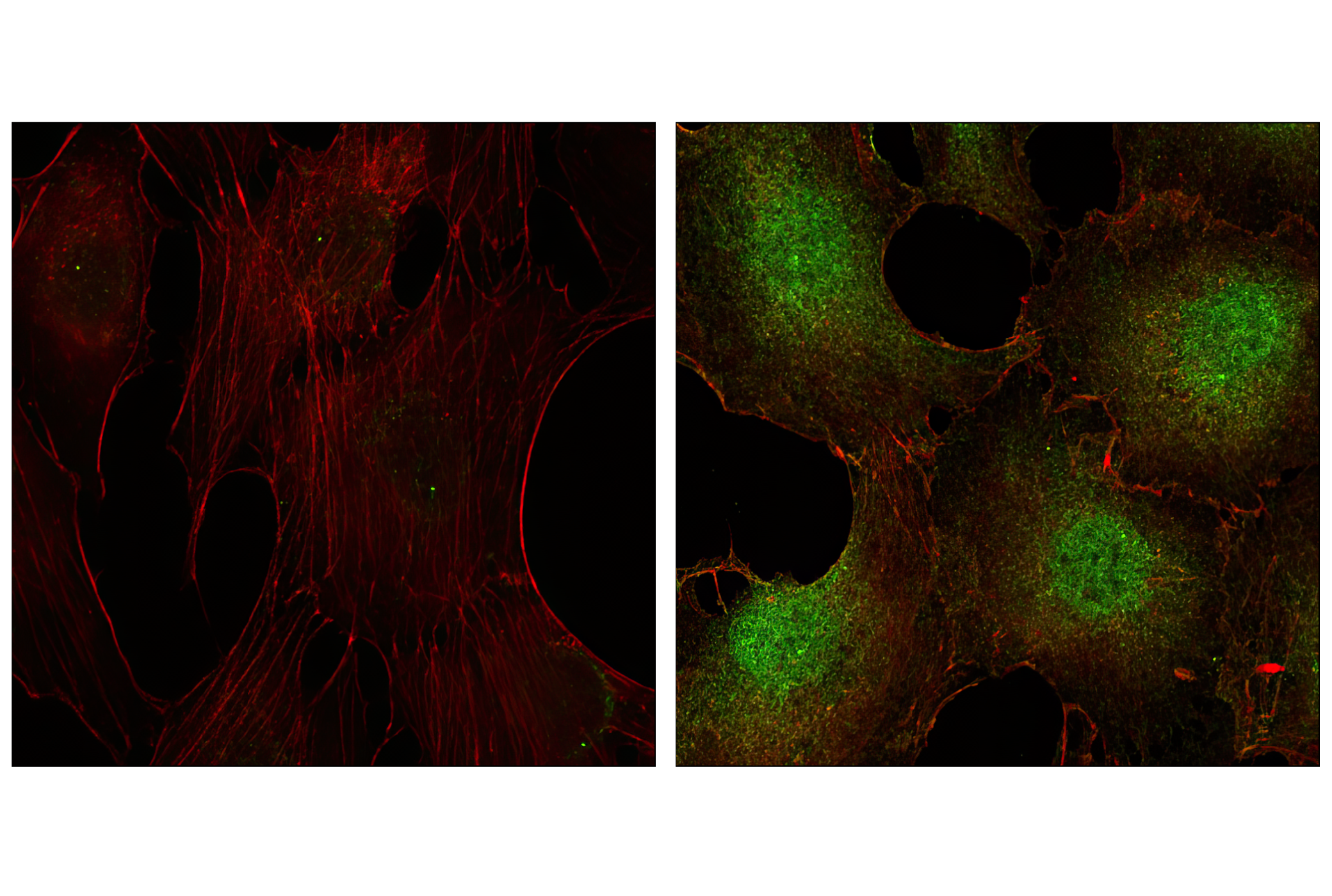 Immunofluorescence Image 1: Phospho-p44/42 MAPK (Erk1/2) (Thr202/Tyr204) Antibody