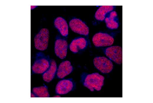Immunofluorescence Image 2: CREB (86B10) Mouse mAb