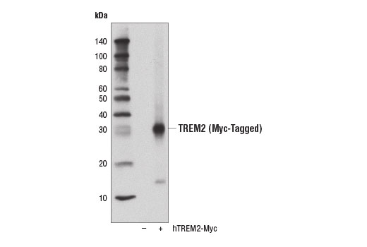  Image 13: TREM2 Signaling Pathways Antibody Sampler Kit