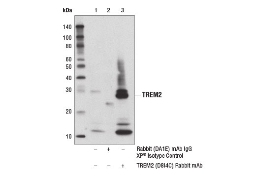  Image 27: TREM2 Signaling Pathways Antibody Sampler Kit