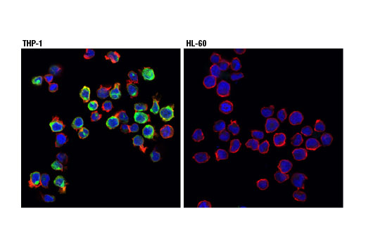 Immunofluorescence Image 1: TREM2 (D8I4C) Rabbit mAb
