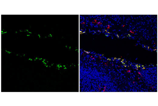 Immunofluorescence Image 1: MSR1 (E4H1C) Rabbit mAb