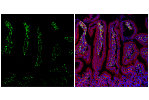 Immunofluorescence Image 2: MSR1 (E4H1C) Rabbit mAb