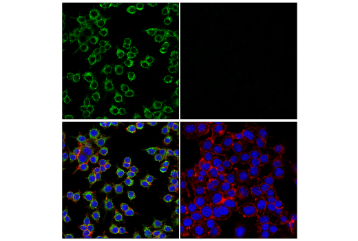 Immunofluorescence Image 5: MSR1 (E4H1C) Rabbit mAb