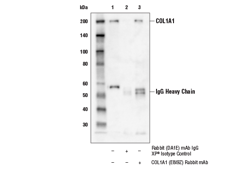 Immunoprecipitation Image 1: COL1A1 (E8I9Z) Rabbit mAb