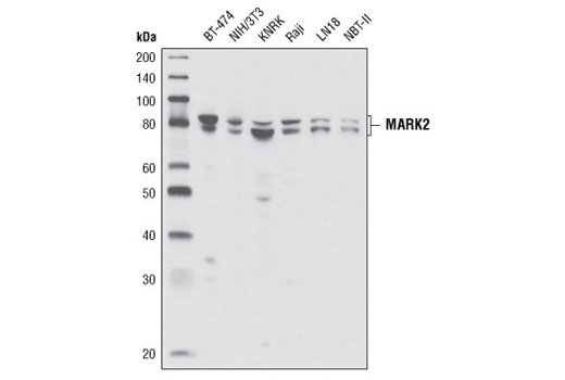Western Blotting Image 1: MARK2 Antibody