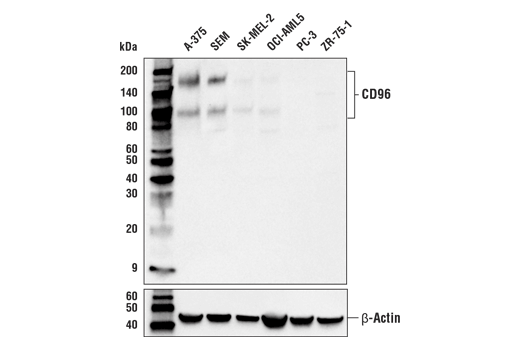 Western Blotting Image 1: CD96 Antibody