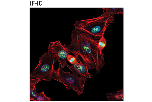 Immunofluorescence Image 2: Ki-67 (D3B5) Rabbit mAb