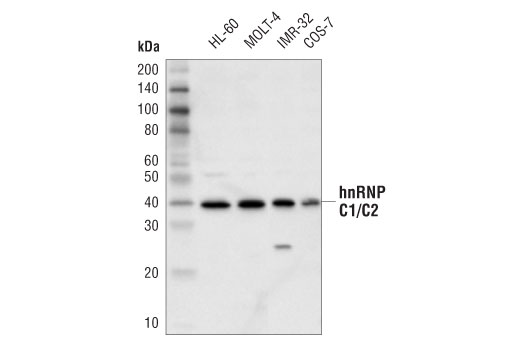 Western Blotting Image 1: hnRNP C1/C2 (D6S3N) Rabbit mAb