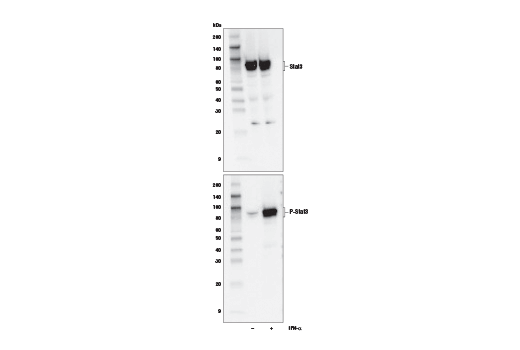 Western Blotting Image 2: Stat1/2/3/5 Control Cell Extracts