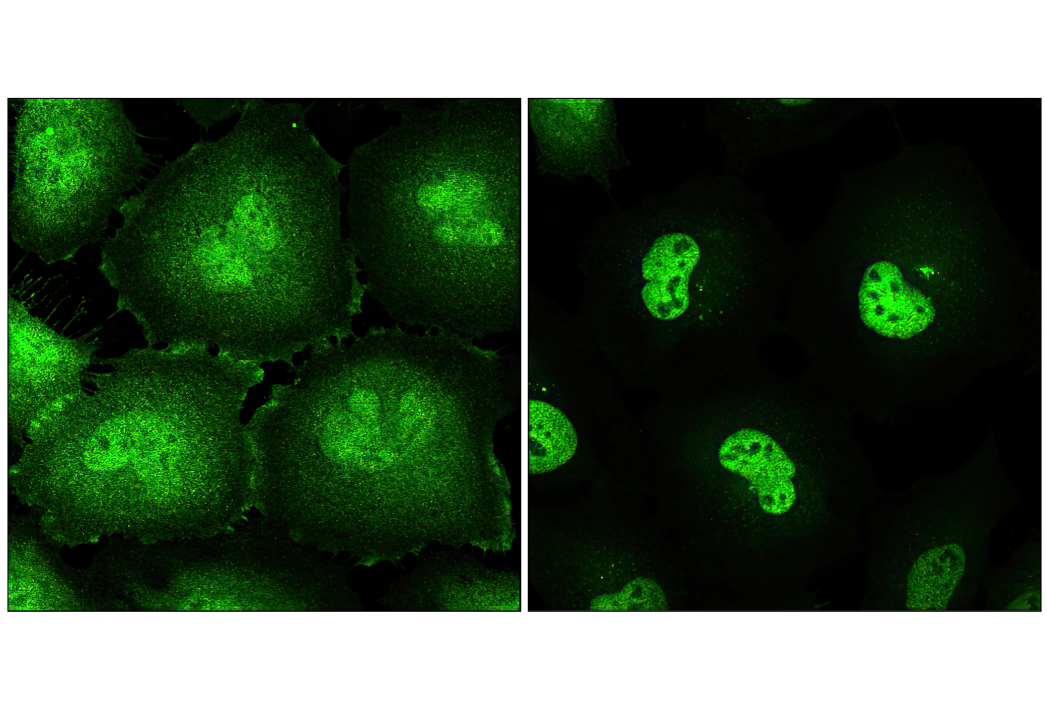 Immunofluorescence Image 1: Stat3 (124H6) Mouse mAb