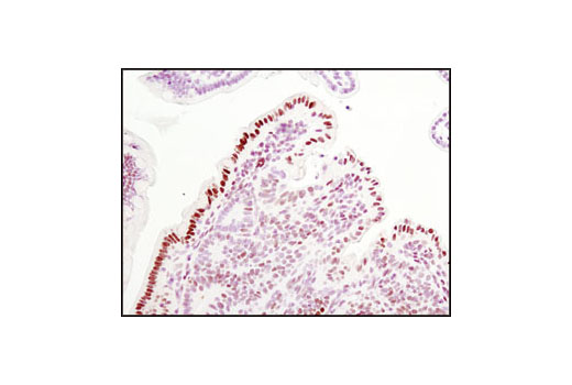 Immunohistochemistry Image 3: Phospho-Stat3 (Tyr705) (D3A7) XP® Rabbit mAb