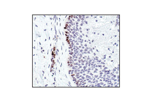  Image 35: ALK Activation Antibody Sampler Kit