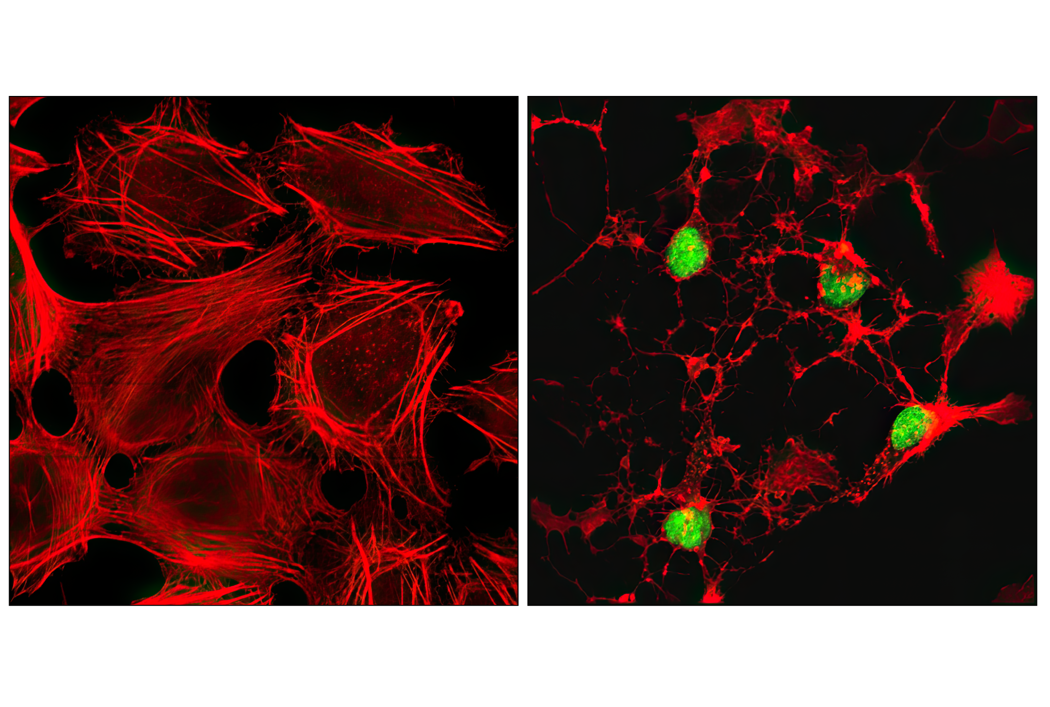 Immunofluorescence Image 1: Cleaved PARP (Asp214) (D64E10) XP® Rabbit mAb (Alexa Fluor® 488 Conjugate)