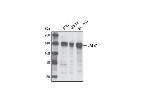 Western Blotting Image 1: LATS1 Antibody