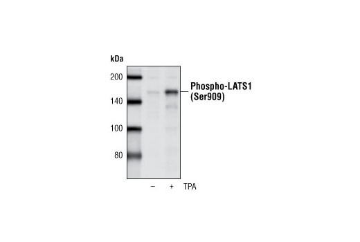 Western Blotting Image 1: Phospho-LATS1 (Ser909) Antibody