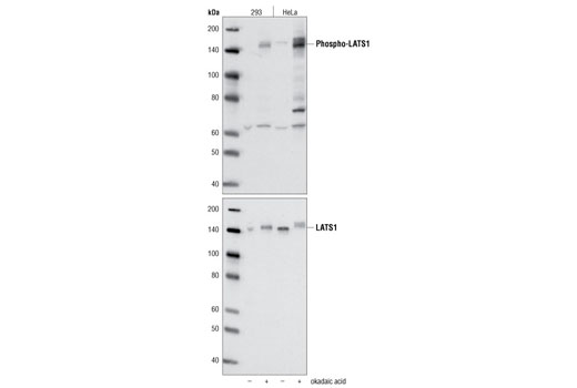 Western Blotting Image 1: Phospho-LATS1 (Thr1079) Antibody