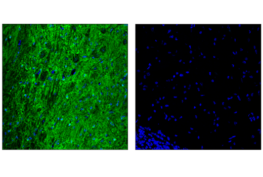 Immunofluorescence Image 1: Phospho-Tau (Ser404) (D2Z4G) Rabbit mAb (Alexa Fluor® 488 Conjugate)